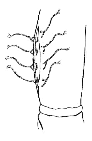 Figure 4: the leg opening