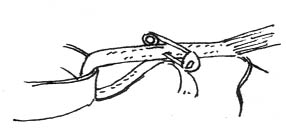 Figure 5: Using a Safety Pin to Fasten the Band