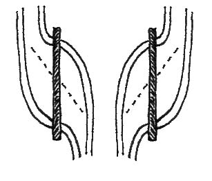 Figure 6: "S" and "Z" Threaded Tablets (top view) 